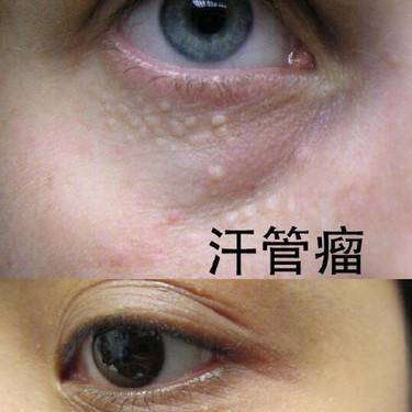 眼科其他