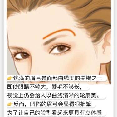 膨体垫眉弓