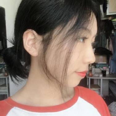 自体软骨垫鼻尖