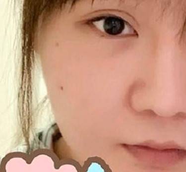 眼睑下至