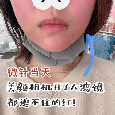 少女针注射