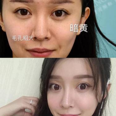 皮肤检测