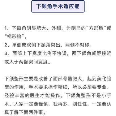 下颌角整形