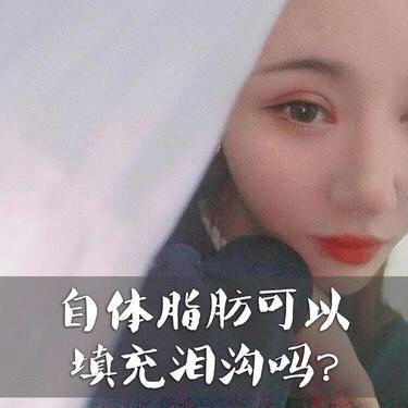 自体脂肪填充泪沟
