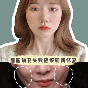 脂肪填充失败修复