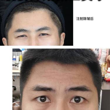 皮肤检测