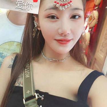 自体脂肪填充泪沟