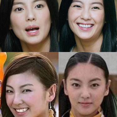 皓齿美白