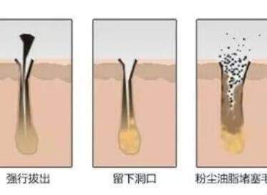 小气泡