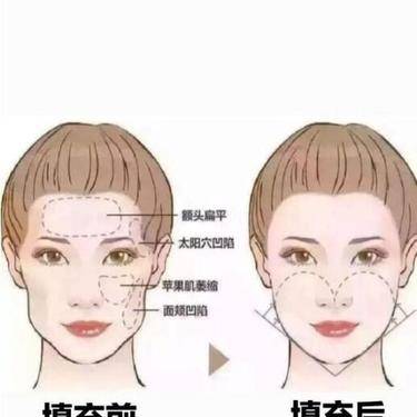 产后塑形