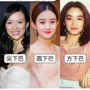 下巴后缩