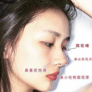 鼻基底
