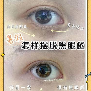祛黑眼圈