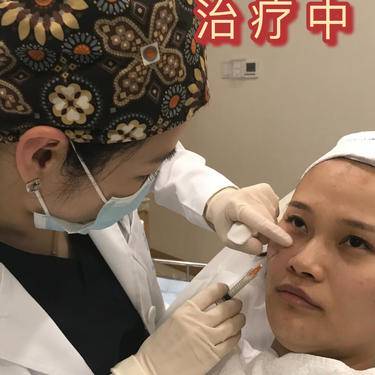 胶原蛋白改善面部细纹