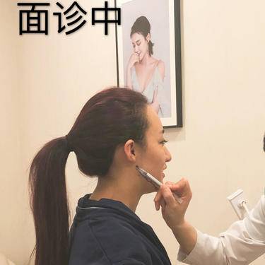 埋线去眼袋