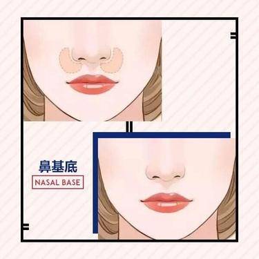 鼻基底