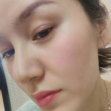 童颜针注射