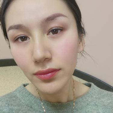 童颜针注射