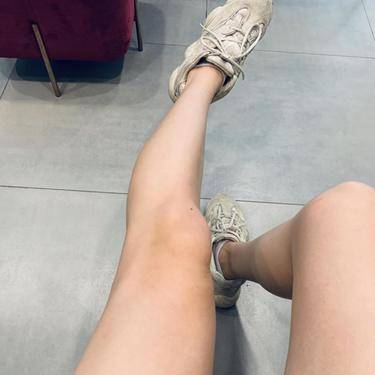 腿骨整形