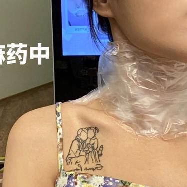 嗨体淡化颈纹