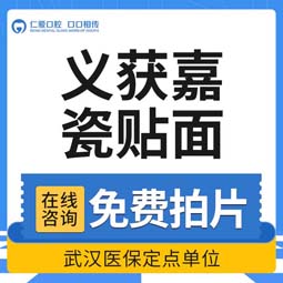 牙齿瓷贴面【武汉@武汉仁爱口腔】