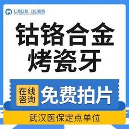 【合金烤瓷牙】【烤瓷牙】生物钴铬合金烤瓷牙