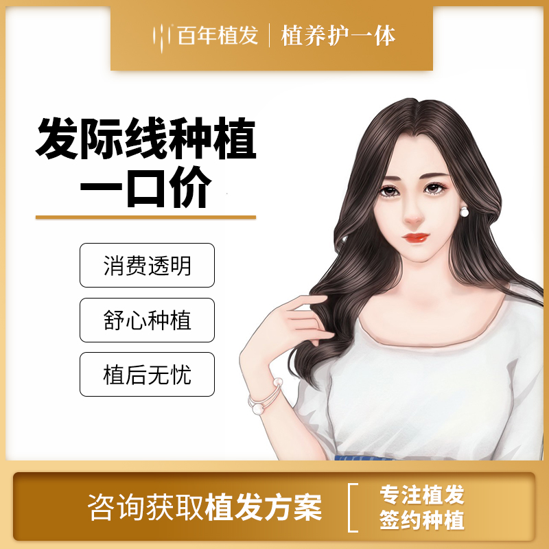 植发际线【苏州@百年植发（苏州总院）】