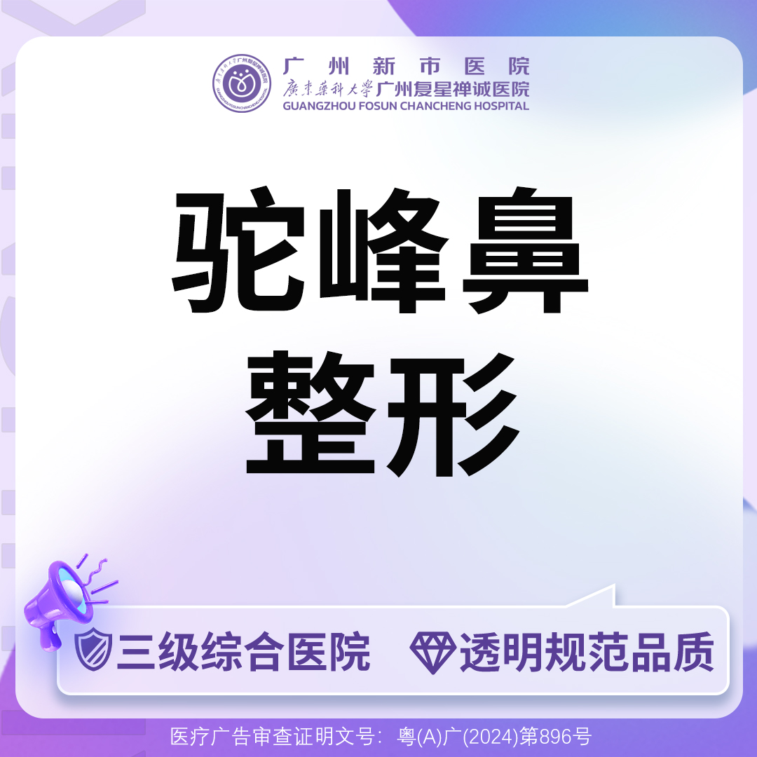 驼峰鼻矫正【广州@广州新市医院】