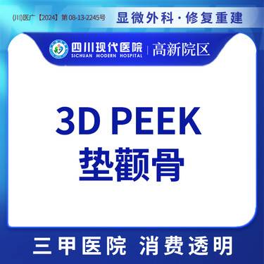 【颧骨提高】3D PEEK 垫颧骨