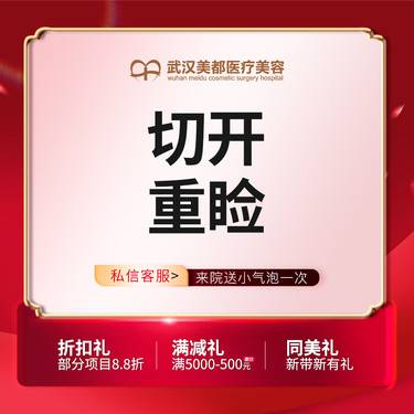 【全切双眼皮】切开双眼皮 双眼皮手术