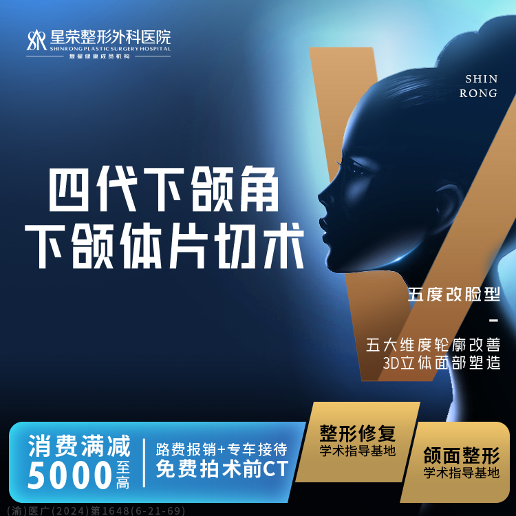 下颌角整形【重庆@刘正茂】