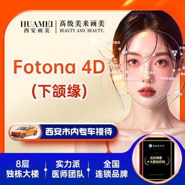 【Fotona4D】FONOTA4D下颌缘【新客专享】整形项目图片