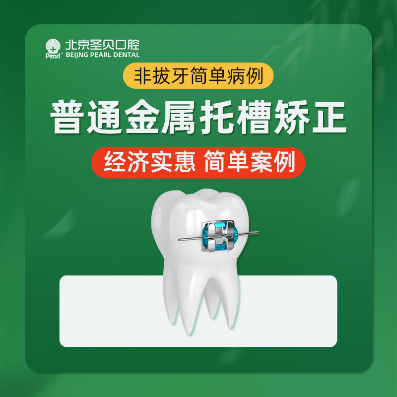 【金属托槽矫正】金属托槽牙齿矫正/正畸/正牙/矫正/地包天/深覆合/牙齿不齐/牙列，北京两店通用