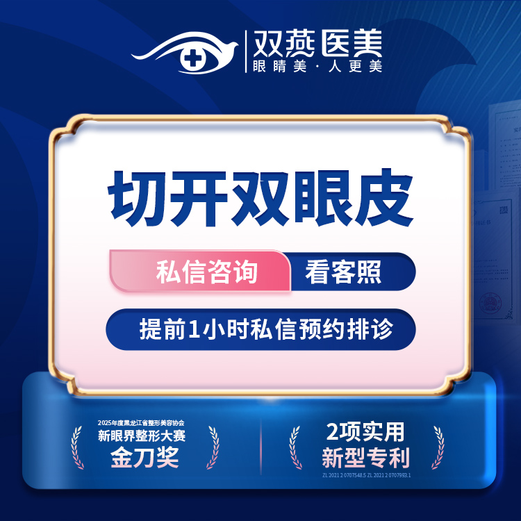 全切双眼皮【哈尔滨@滕双艳】
