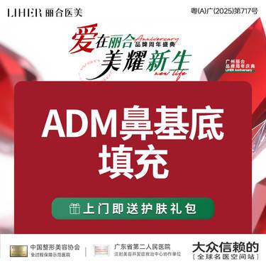 【假体垫鼻基底】【博士后 权威鼻专家】ADM填充鼻基底原位鼻基底填充鼻部整形