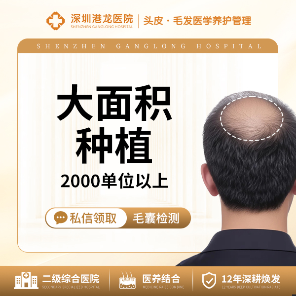 头顶加密种植【深圳@深圳港龙医院】