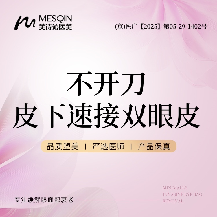 埋线双眼皮【北京@徐飞】