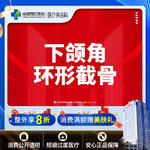 【下颌角切除】成都西区医院 下颌角环形截骨