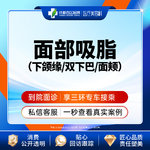 【吸脂瘦脸】脸部，面部吸脂 下颌缘/双下巴/面颊  三选一
