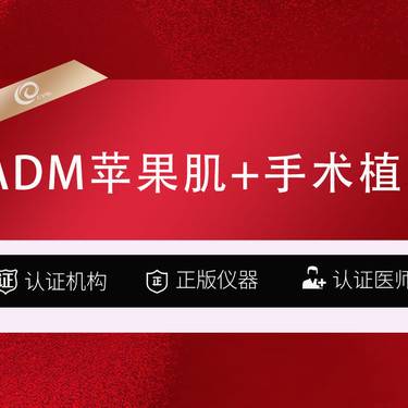 【真皮丰卧蚕】ADM真质苹果肌+手术植入-adm丰苹果肌自体脂肪填充整形项目图片
